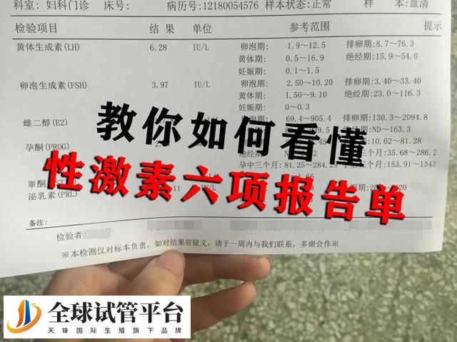 教你如何看懂性激素六项报告单！